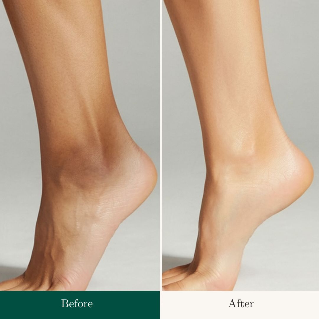 Before After 24